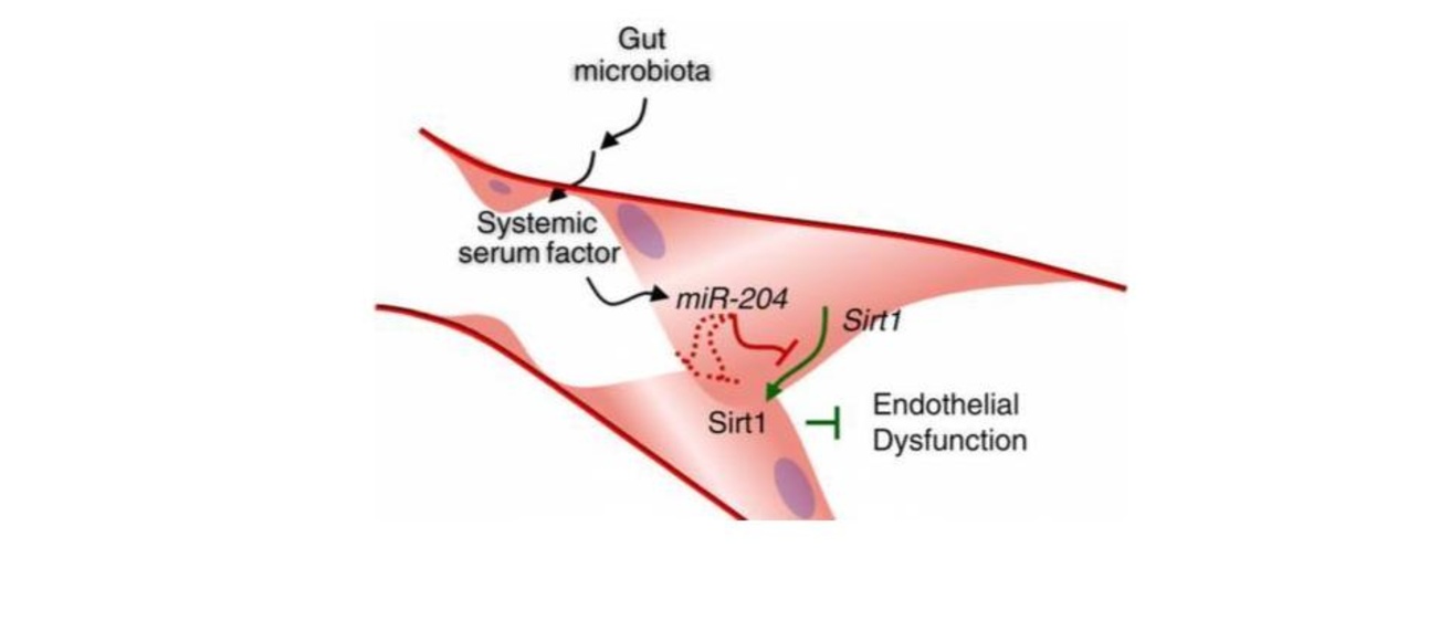 Hypertension Research