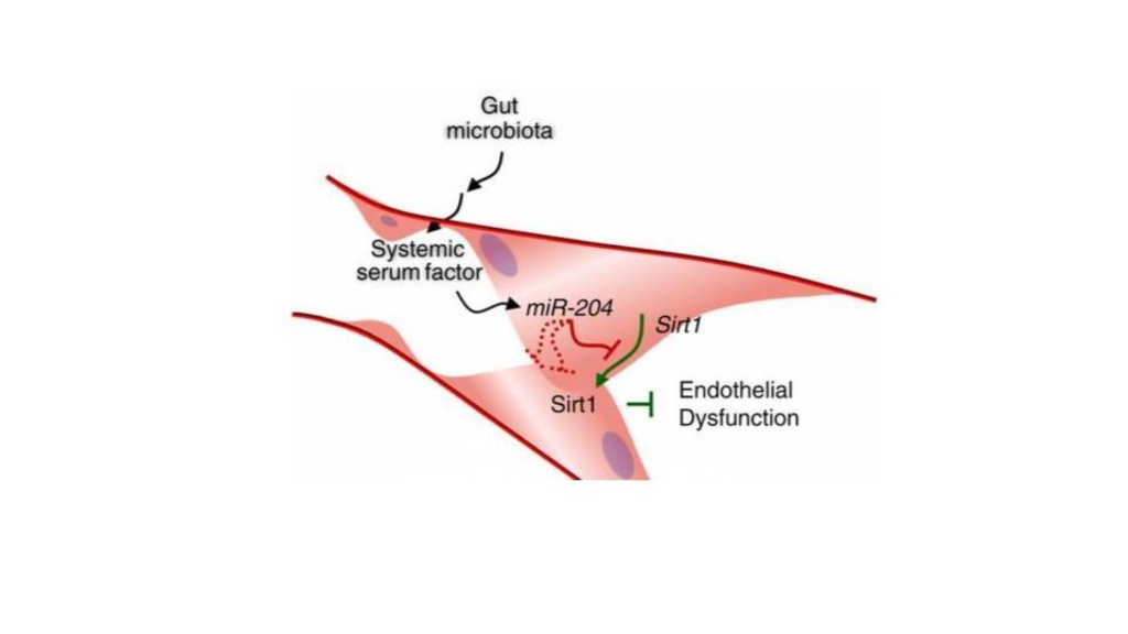 Hypertension Research